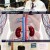 생로병사의 비밀.E802.211124.720p-NEXT