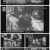 어린이날 특집 현대사 영상프로젝트.220505.1080p.H264-F1RST