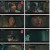 블라인드.E13.221028.1080p.H264-F1RST.mp4